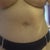 6 week- belly button