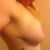 four months post op