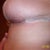 Post op week 5