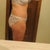 18 days after additional lipo