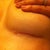 Left scar 4 weeks