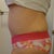16 weeks po