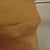 16 weeks po dog ear