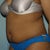 Pre-Op