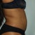 3 Months Post Op