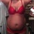 6days pre op front