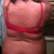 6days pre op back