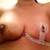 Stiches out on left breast with tape on. Stitches still in on right breast. Still leaking fluid and black under breast.