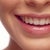Remember when Orthodontist used to shape everyone's teeth like this? Well, I like teeth that slant in,  maybe not as extreme but sort of this.  (Not my teeth.)