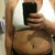 3 weeks PO, super swollen!