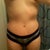 6 weeks post op