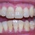 4-29-2013 Refinement Tray 5/26