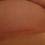 my scar (infra-mammary)