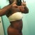 right side - 3 weeks post op