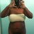 front view.  stil swollen.... love handles going in some... - 3 weeks post op.  ( i keep telling myself 'patience child')