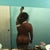 back - 3 weeks post op.  still very swollen in back scoop area and a little tender to touch. - 3 weeks post op