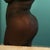 butt close view - 3 weeks post op