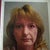 Here is a before picture taken with a window shining on the left side of my face. The nasial labia fold and marionette line on the right side are shadowed. So during surgery, the left side of my face was lifted. I woke up with a sagging right side.