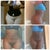 5 of 6 collages I showed dr. P. love the hips, reesyvaughn, salhauzer patient.