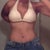 2 months post op