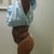 SIDE - before lipo - day 4