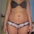 Front veiw before lipo suction