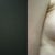 This is not my photo, I deleted mine, however these look pretty close to my results, except the before should be much more drooped.