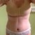 Tomorrow will be 4 weeks PO.  Swollen from doing too much.