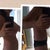Before and after 3 days post op