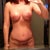 4 weeks post op