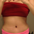 6 weeks post op