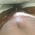 Hours after surgery!!! My scar is super low & she eliminated so many stretch marks !!!!!