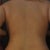 day 12 po, had lipo on the flanks i think it def looks less muffin top lol