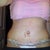 6dayPO