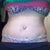 7day PO