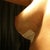 12 days: right breast, looking good!
