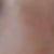 5.5 weeks post op - smiling