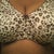 Pre-op Size 40 "G" UGH!