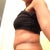 6.5 weeks PO side view