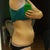 side, the kinda bad.. I had flank lipo done a few years back..they took the max out they could safely take(9lbs)... you can see i still have a bit of love handle so i hope he gets that during surg.