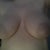 Just seeing how bad these look make me have no doubts about this surgery!