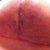 Left side underneath at 4 weeks.  Pretty much closed up.