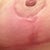 Right barely scar and haven't used anything