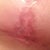 The bad spot all healed!'n yay