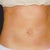 Anterior view 8 weeks later. This picture does not begin to do it justice but it is so hard to properly photograph something like this
