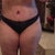 These are my lowest panties, barely covering the incision