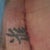 Close up of incision Day 3 Post Op - looks like I may of lost a little of the top of the tattoo. Just means I'll have to get it "fixed" - perhaps one around my incision - way down the road.