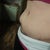 my tummy with the bulge on the right side