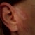 This is what I'm left with after He fixed it and now won't respond to my messages. My ear's cold and painful 24/7 and he did this is January 09 for the last time.
