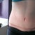 Eleven weeks post op, immediately after a step workout with binder
